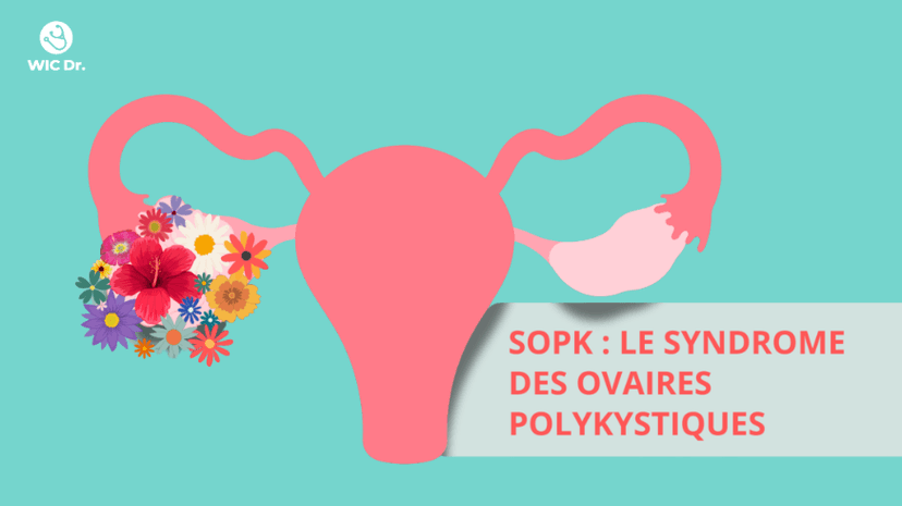 Impact du Jeûne sur le Syndrome des Ovaires Polykystiques (SOPK) : Risques et Conseils pour le Ramadan